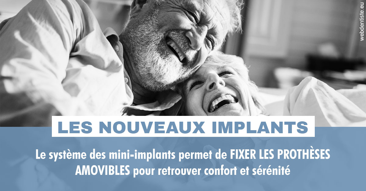 https://selarl-cabinet-dentaire-sevain.chirurgiens-dentistes.fr/Les nouveaux implants 2
