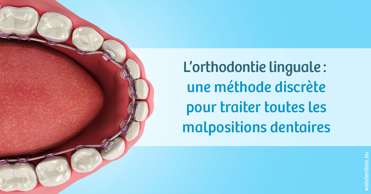 https://selarl-cabinet-dentaire-sevain.chirurgiens-dentistes.fr/L'orthodontie linguale 1