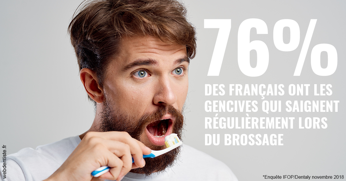 https://selarl-cabinet-dentaire-sevain.chirurgiens-dentistes.fr/76% des Français 2