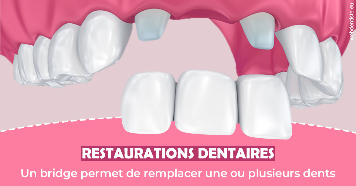 https://selarl-cabinet-dentaire-sevain.chirurgiens-dentistes.fr/Bridge remplacer dents 2