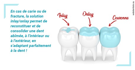 https://selarl-cabinet-dentaire-sevain.chirurgiens-dentistes.fr/L'INLAY ou l'ONLAY
