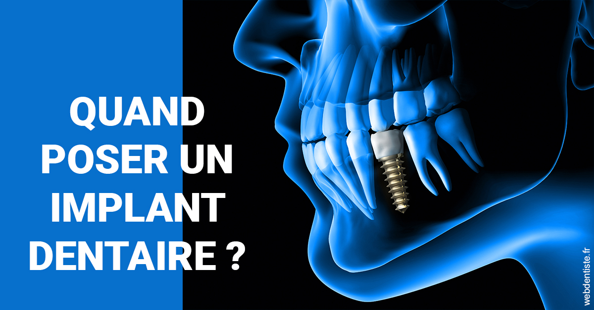 https://selarl-cabinet-dentaire-sevain.chirurgiens-dentistes.fr/Les implants 1