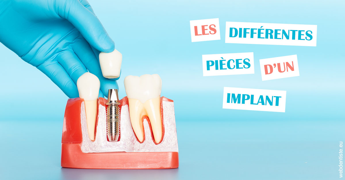 https://selarl-cabinet-dentaire-sevain.chirurgiens-dentistes.fr/Les différentes pièces d’un implant 2