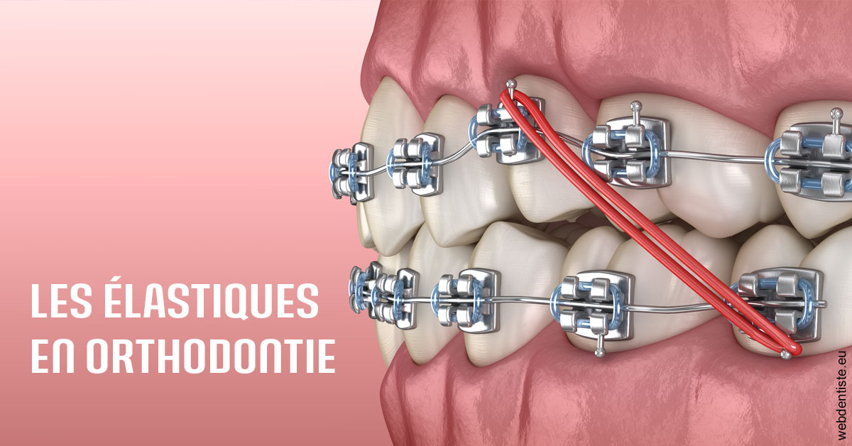 https://selarl-cabinet-dentaire-sevain.chirurgiens-dentistes.fr/Elastiques orthodontie 2
