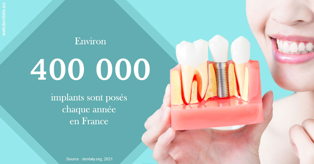 https://selarl-cabinet-dentaire-sevain.chirurgiens-dentistes.fr/Pose d'implants en France 2
